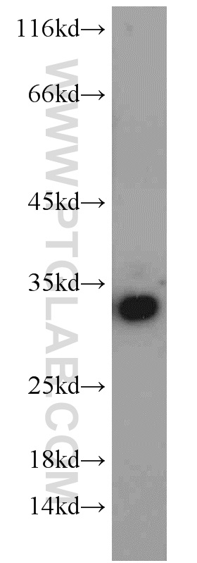 WB analysis of A549 using 55248-1-AP