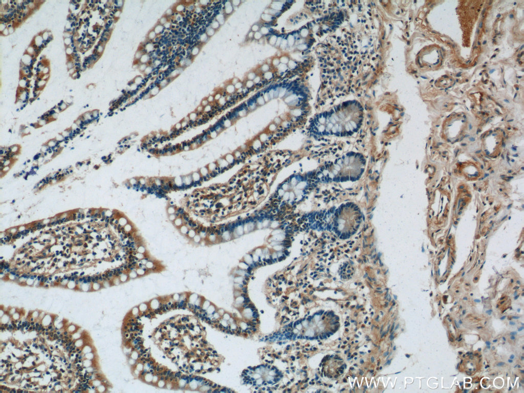 IHC staining of human small intestine using 25264-1-AP