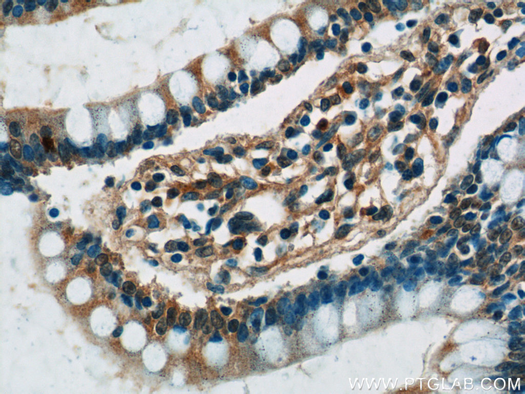 IHC staining of human small intestine using 25264-1-AP