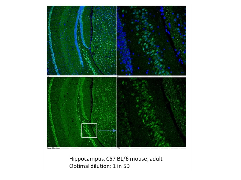 IF Staining of mouse Hippocamus tissue using 21514-1-AP