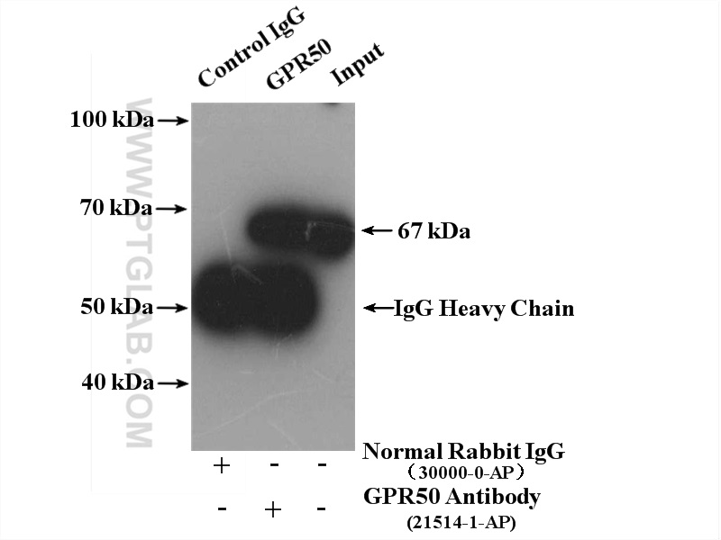 IP experiment of HeLa using 21514-1-AP