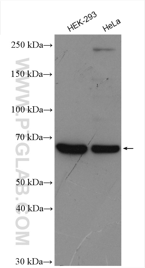 WB analysis using 21514-1-AP