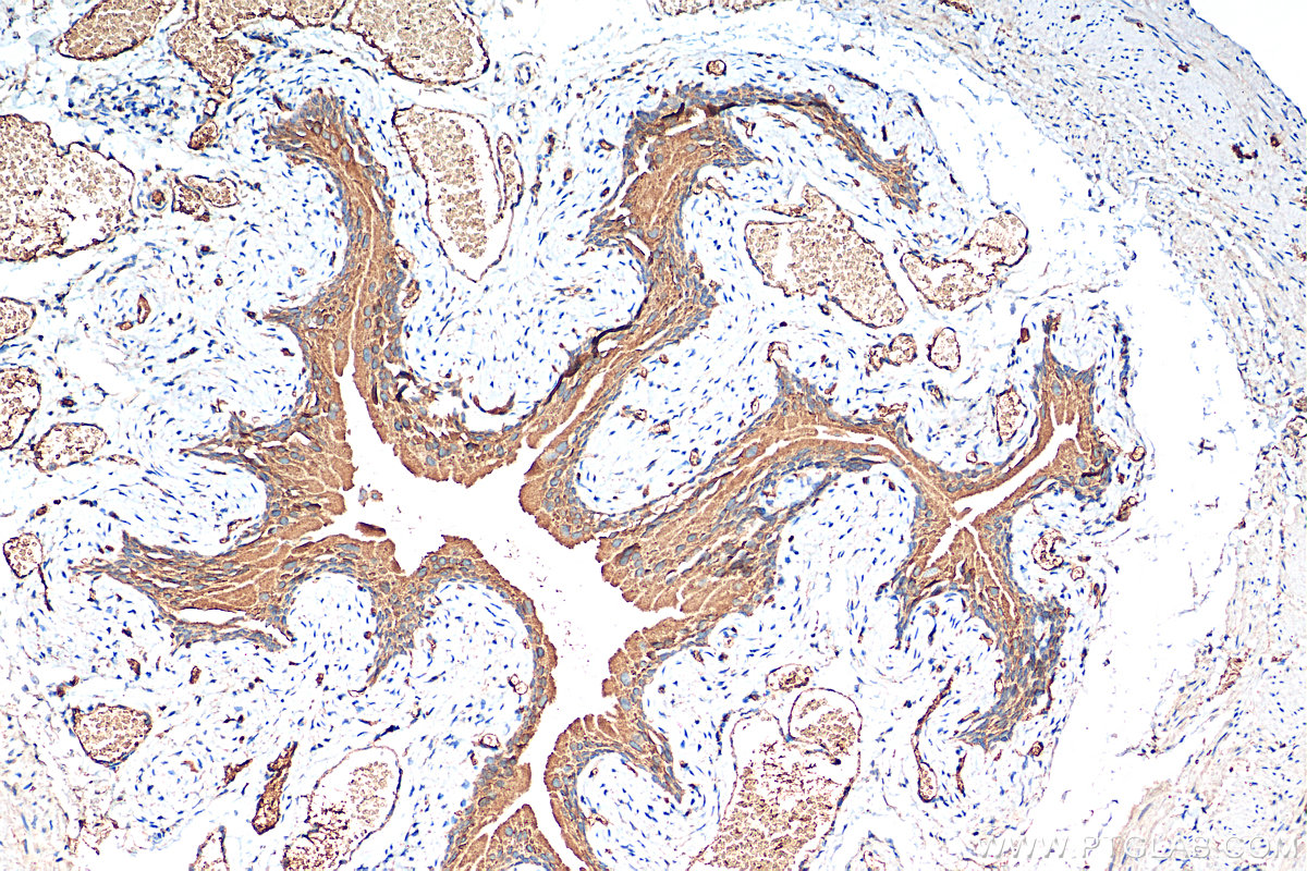 IHC staining of mouse bladder using 25999-1-AP