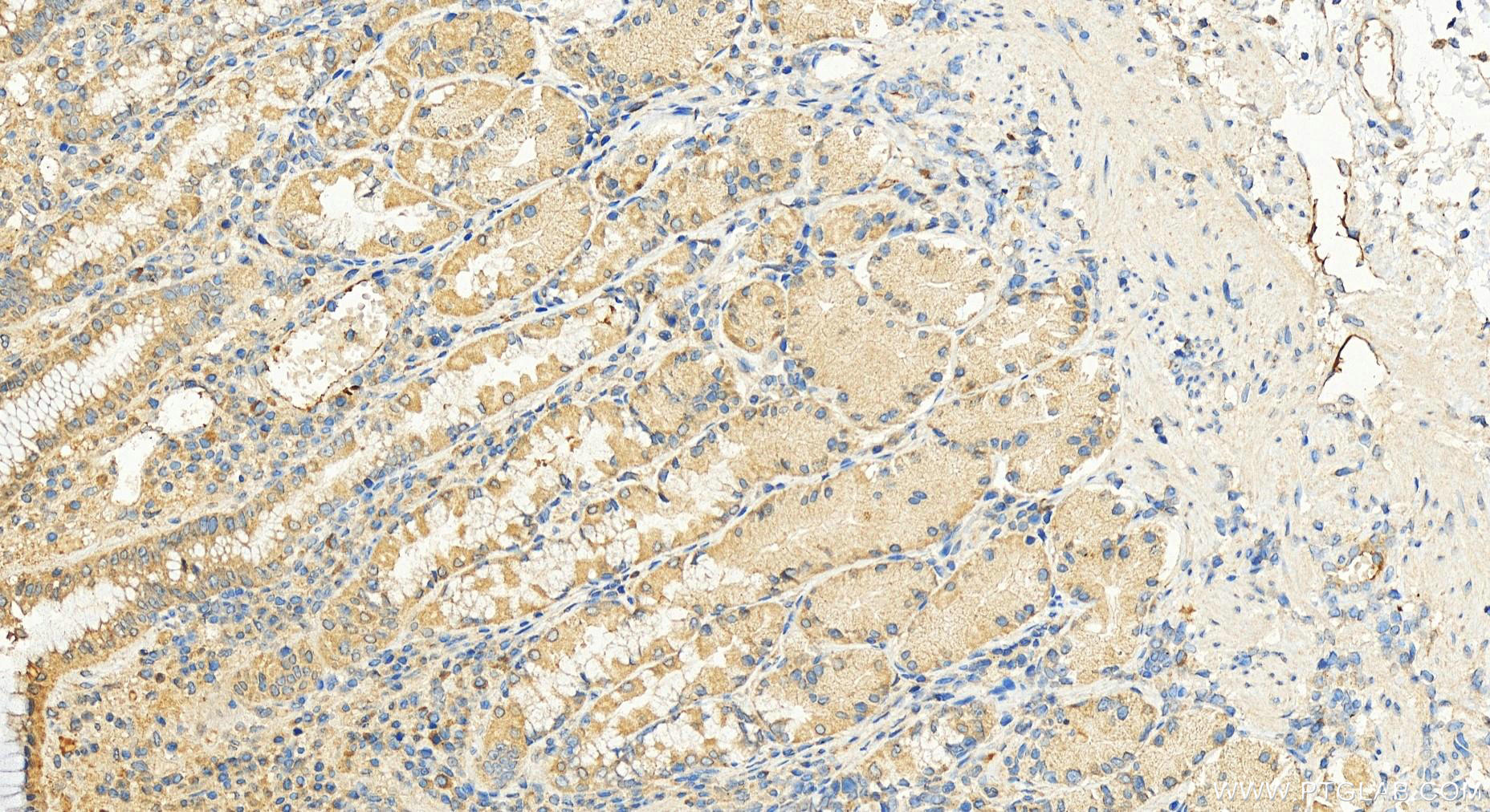 IHC staining of human stomach using 20212-1-AP