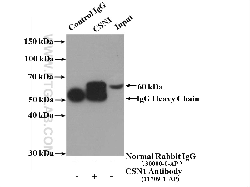 IP experiment of HeLa using 11709-1-AP