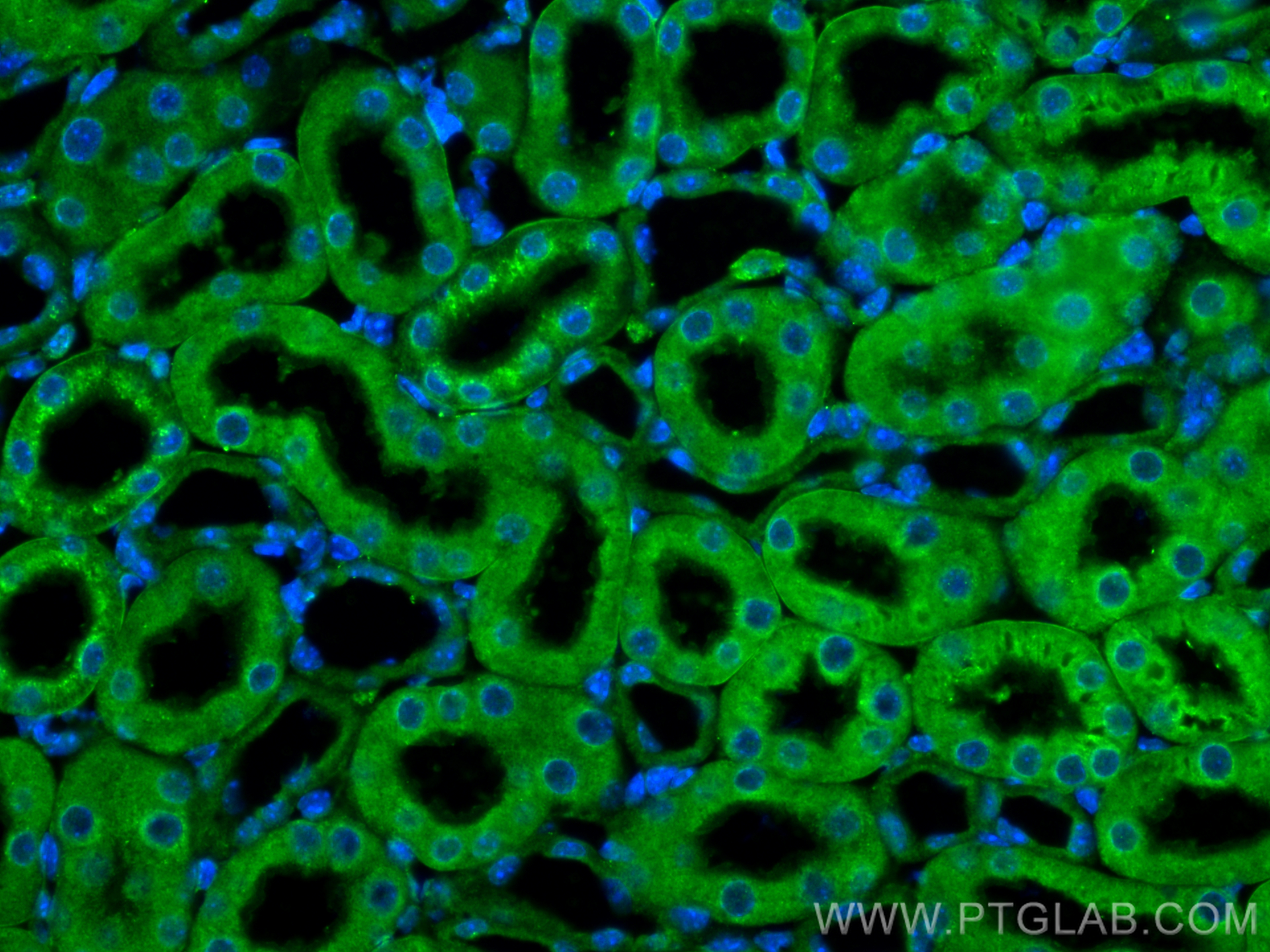 IF Staining of mouse kidney using 13947-1-AP