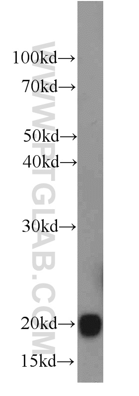 GPX4 Polyclonal antibody