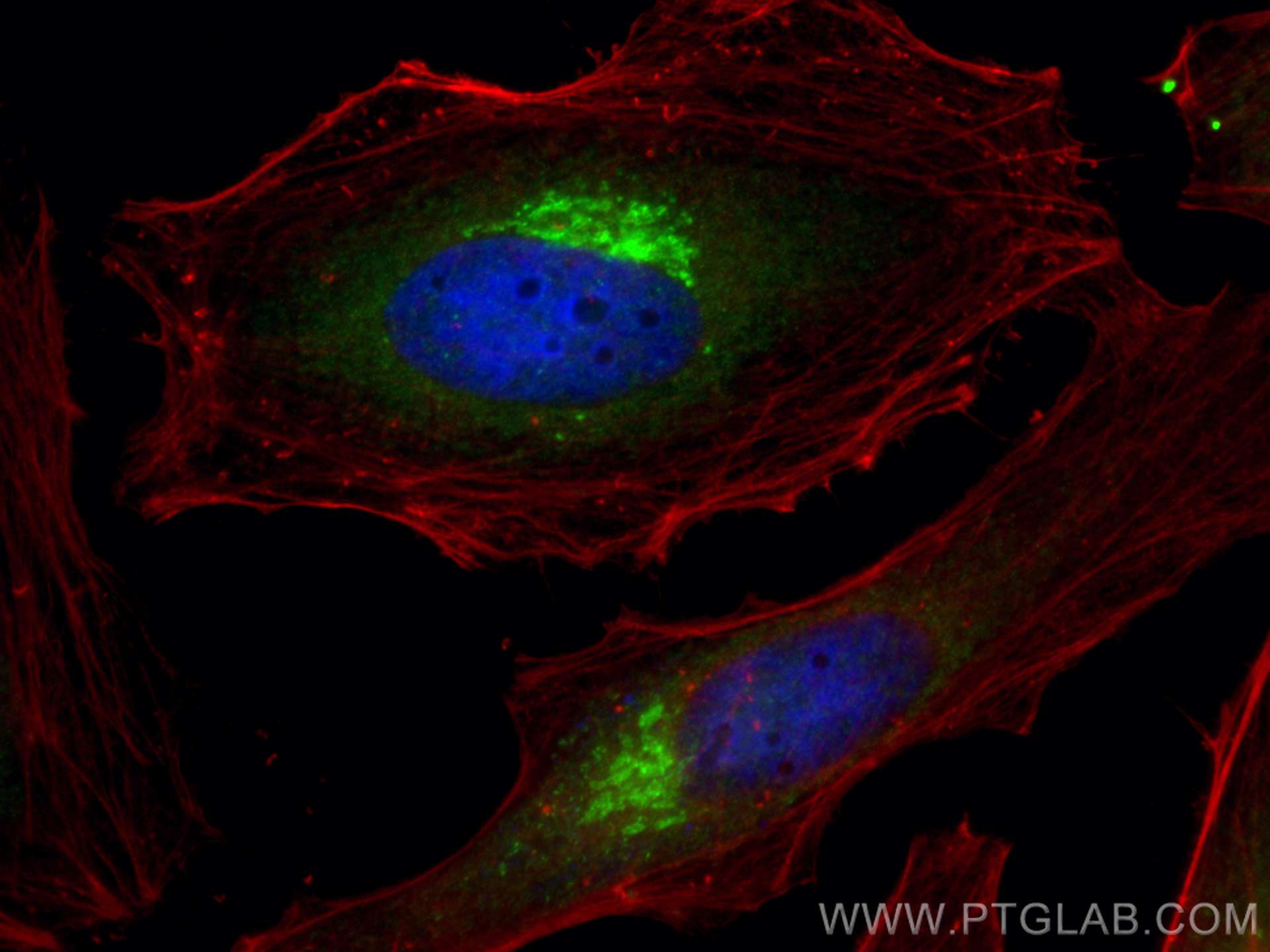 IF Staining of HeLa using 10747-2-AP (same clone as 10747-2-PBS)