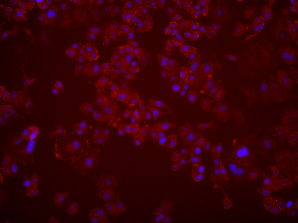 IF Staining of SK-BR-3 using 66651-1-Ig (same clone as 66651-1-PBS)