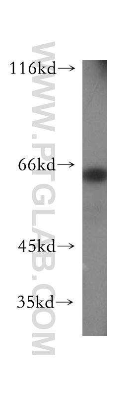 WB analysis of HepG2 using 16622-1-AP