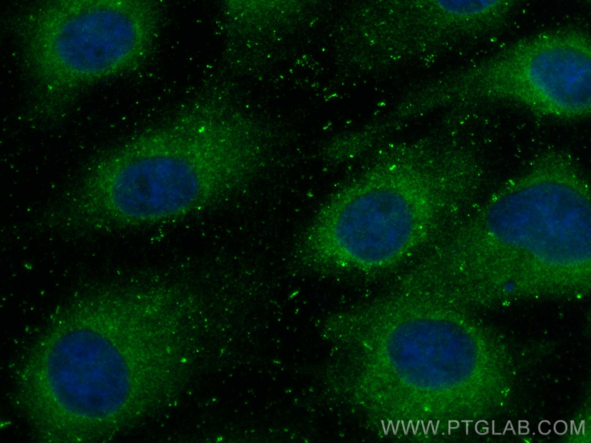 IF Staining of A431 using 10045-1-Ig