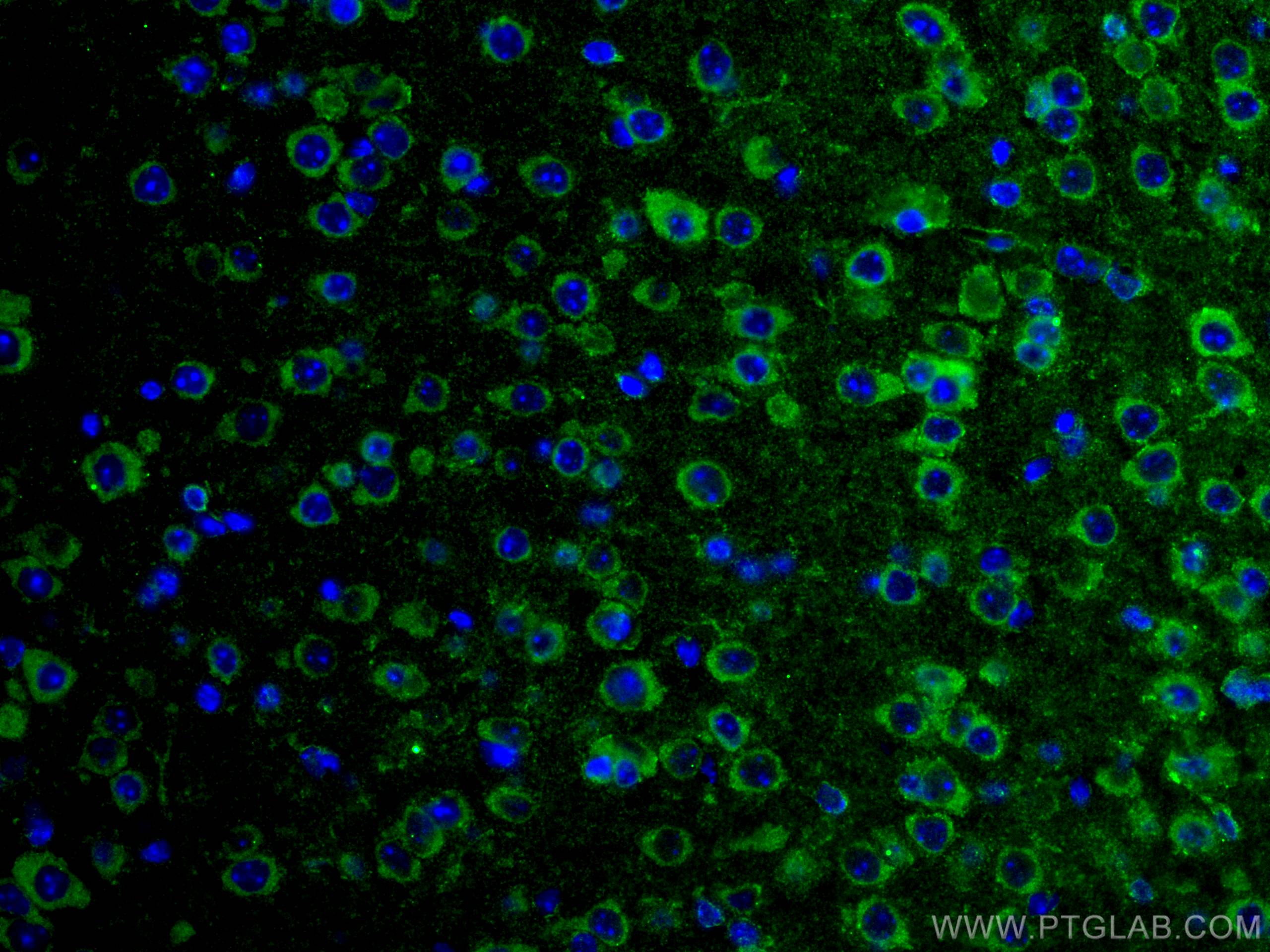 IF Staining of mouse brain using 67642-1-Ig (same clone as 67642-1-PBS)