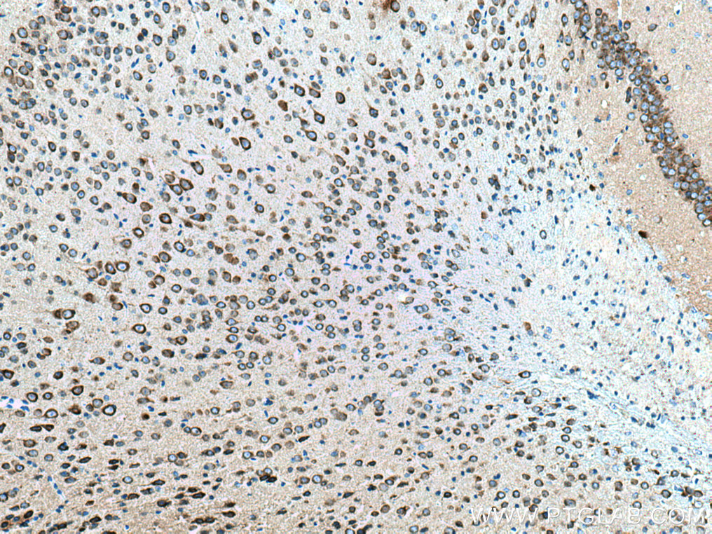 IHC staining of mouse brain using 67642-1-Ig (same clone as 67642-1-PBS)