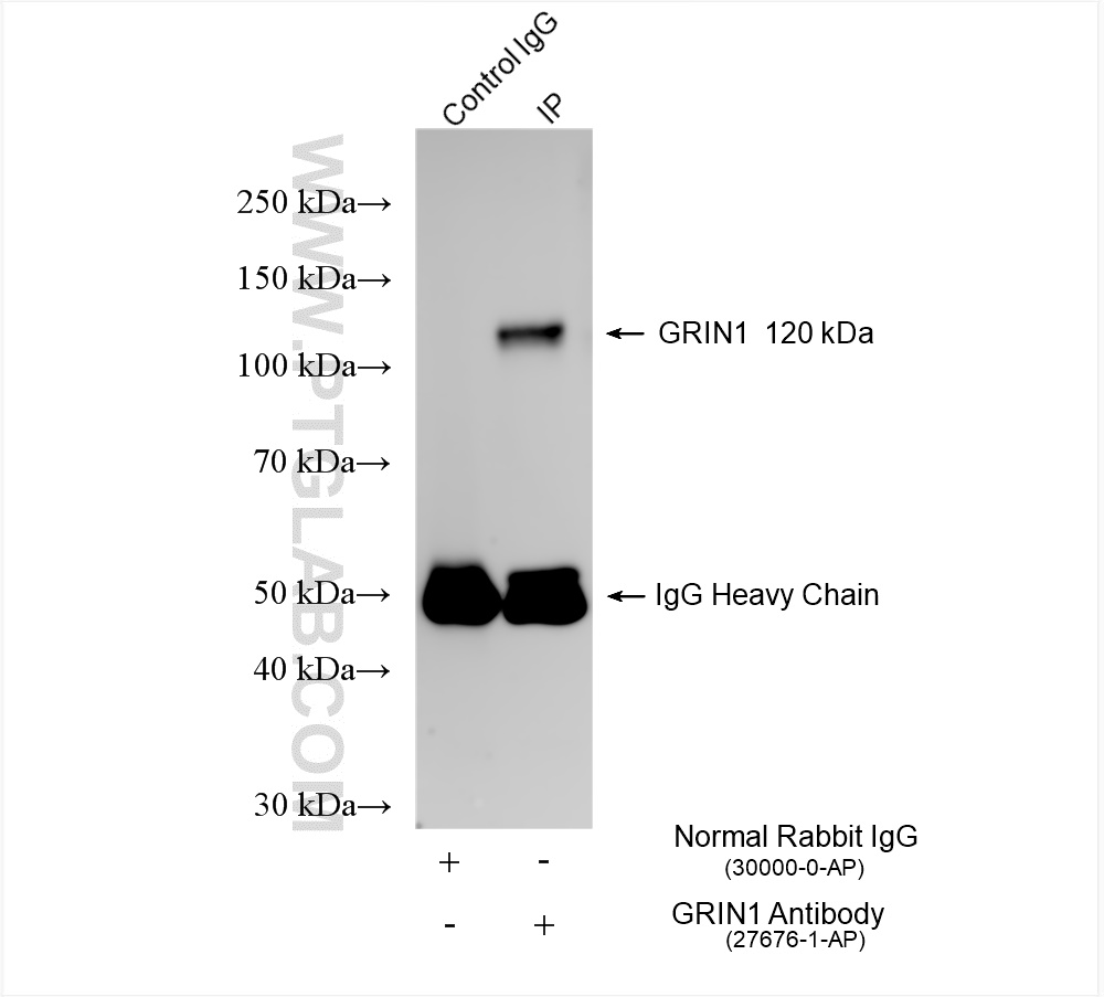 IP experiment of mouse brain using 27676-1-AP