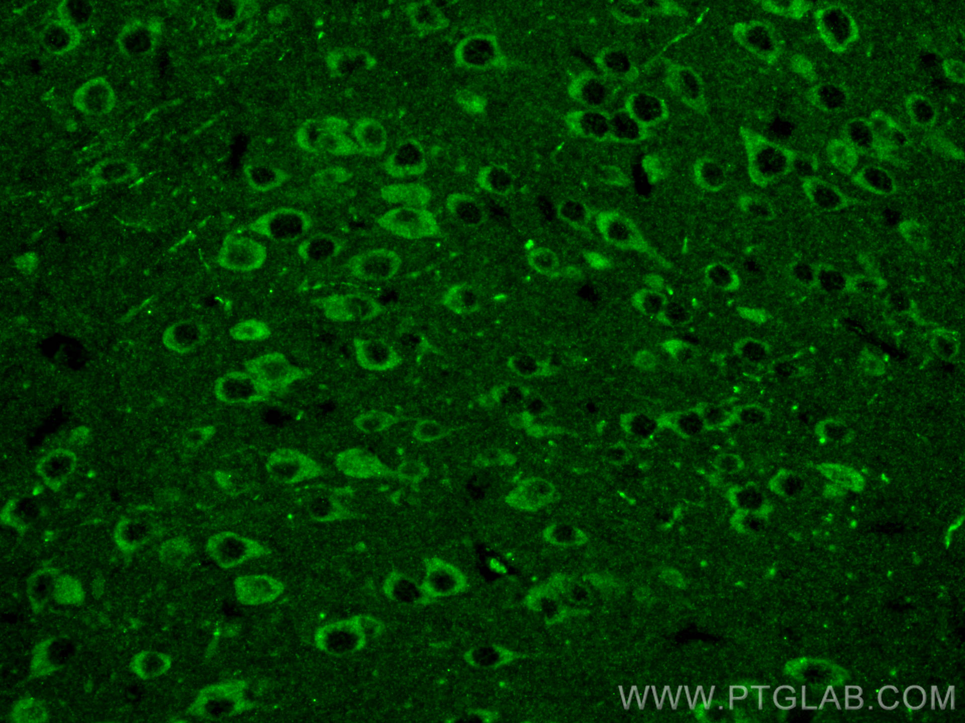 IF Staining of mouse brain using 67717-1-Ig (same clone as 67717-1-PBS)