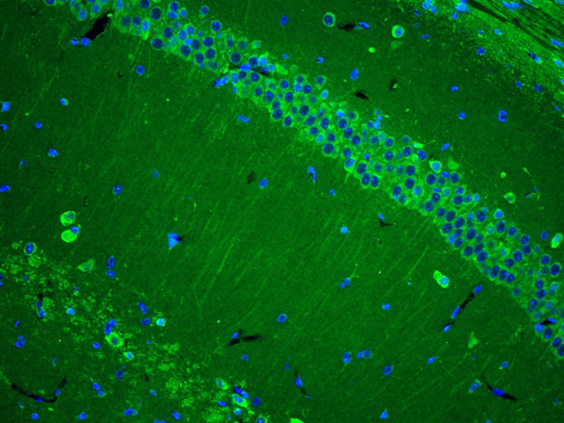 IF Staining of mouse brain using 21920-1-AP
