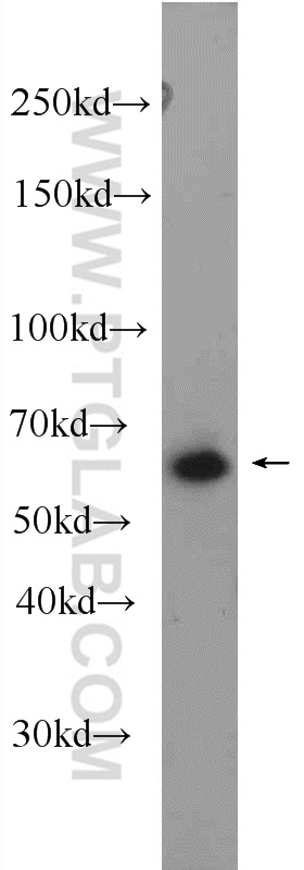 WB analysis of Y79 using 24606-1-AP