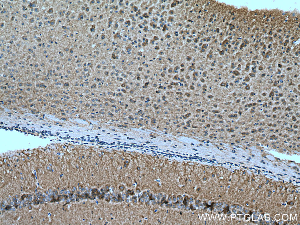 IHC staining of mouse brain using 28834-1-AP (same clone as 28834-1-PBS)