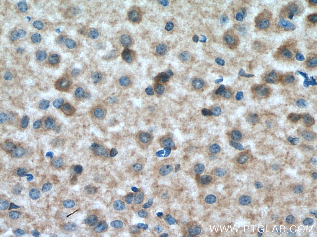 IHC staining of mouse brain using 28834-1-AP