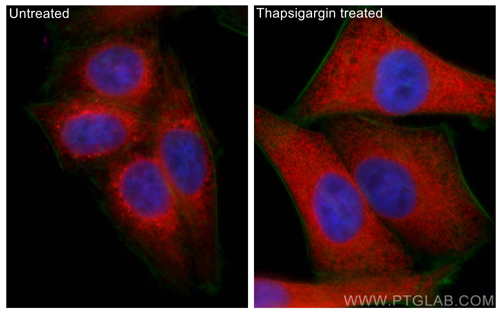 IF Staining of HepG2 using 11587-1-AP