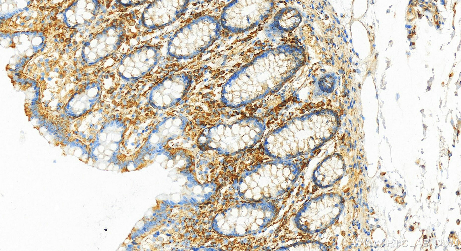 IHC staining of human normal colon using 82805-2-RR (same clone as 82805-2-PBS)