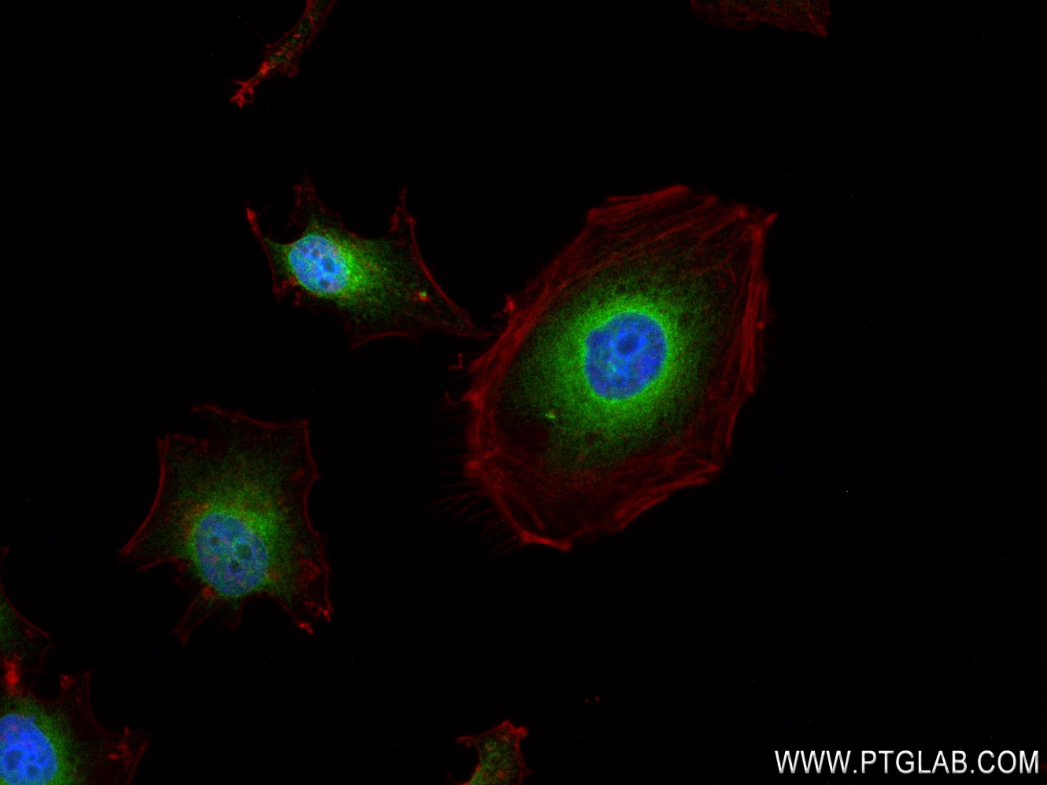 IF Staining of HeLa using 83147-5-RR