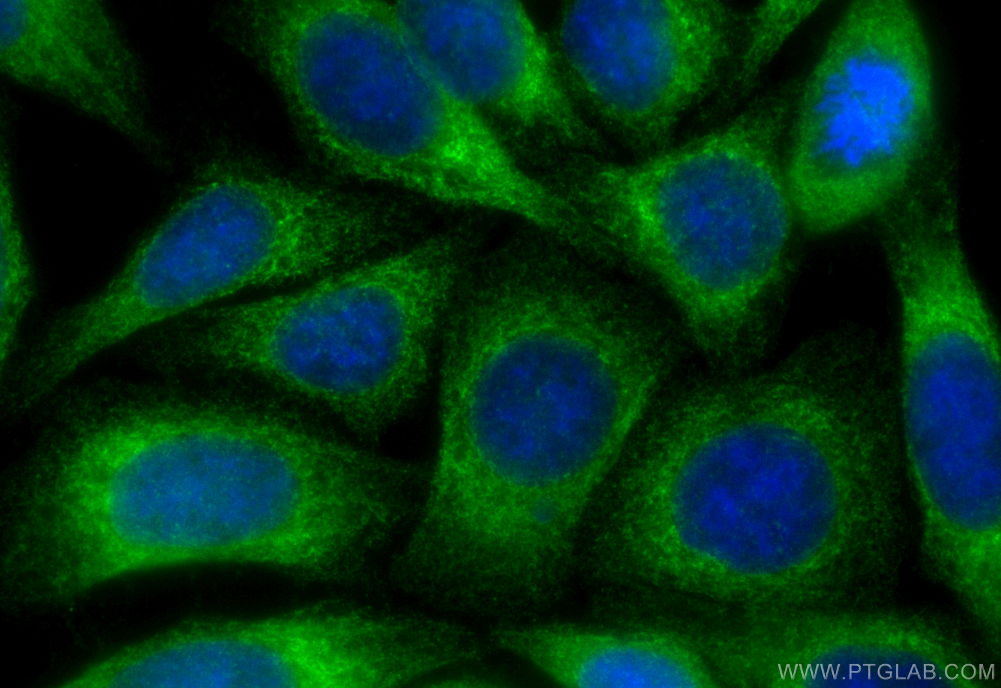 IF Staining of HepG2 using CL488-83147-5