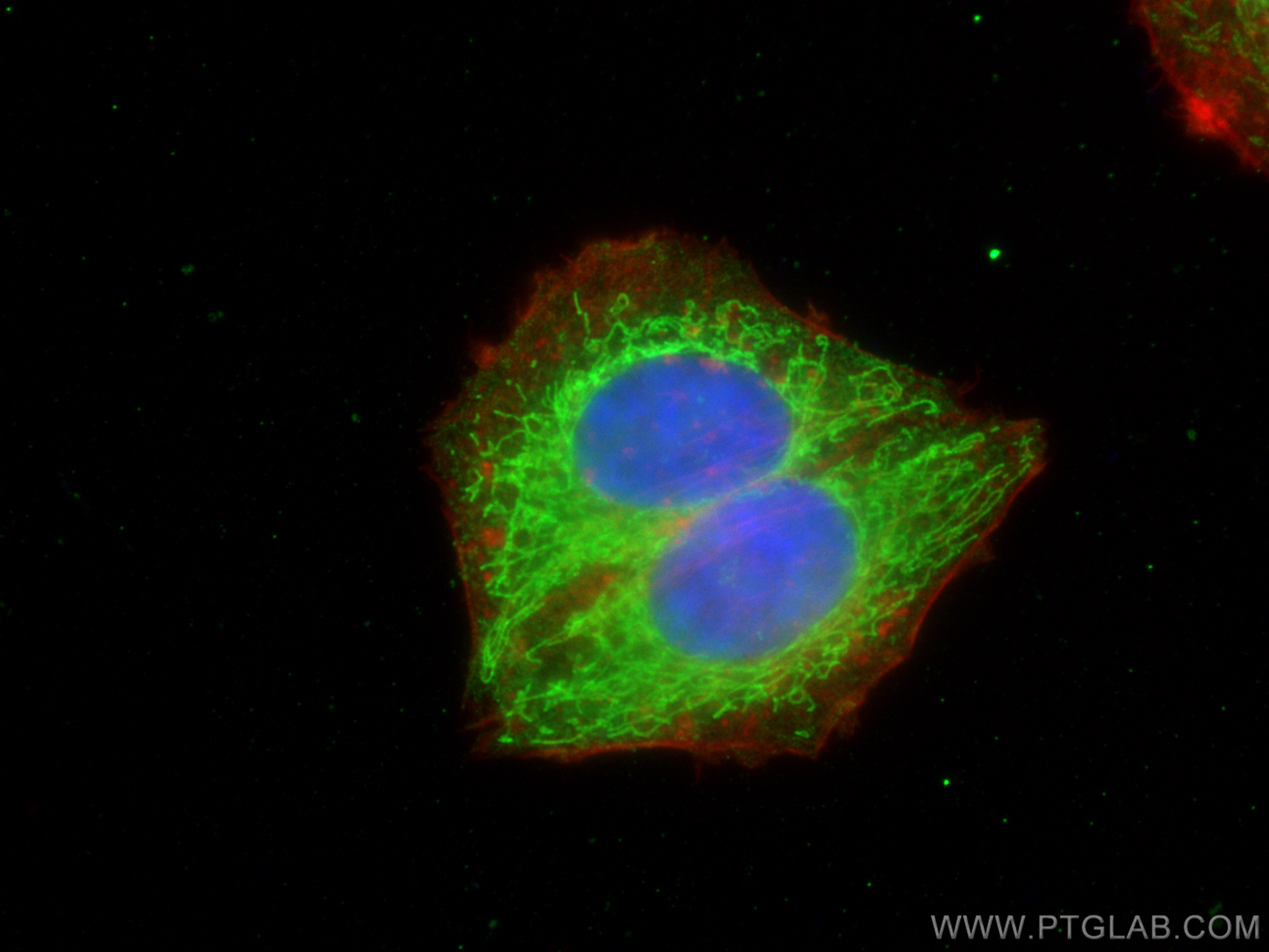 IF Staining of HepG2 using 12720-1-AP