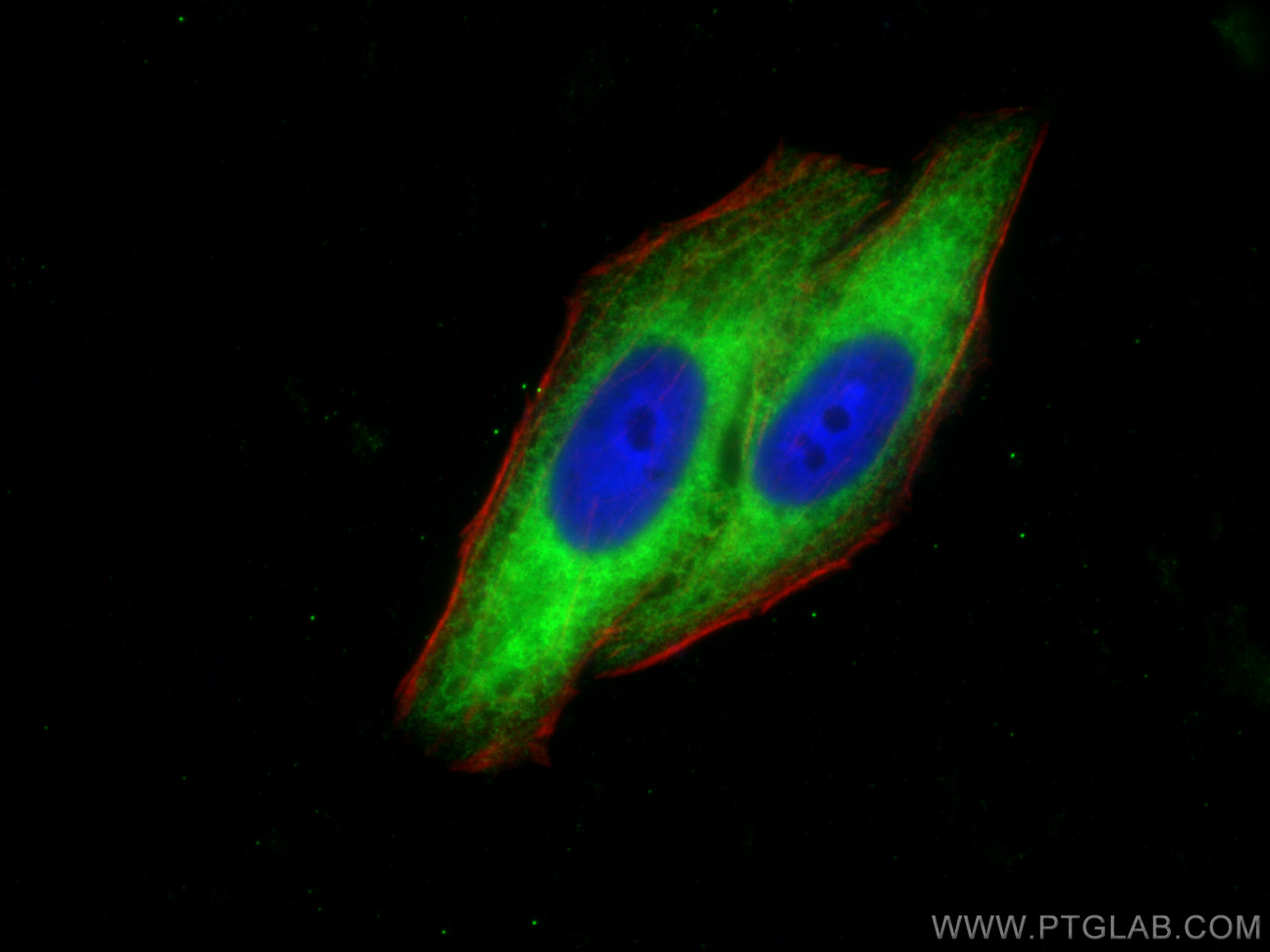 IF Staining of HepG2 using 12720-1-AP