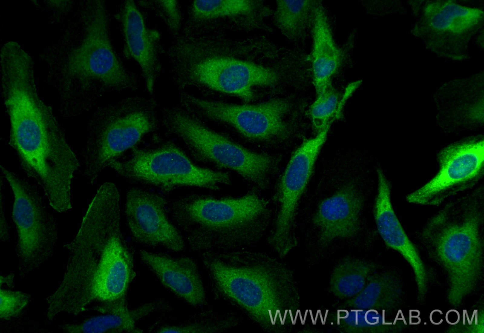 IF Staining of HeLa using 82920-2-RR (same clone as 82920-2-PBS)