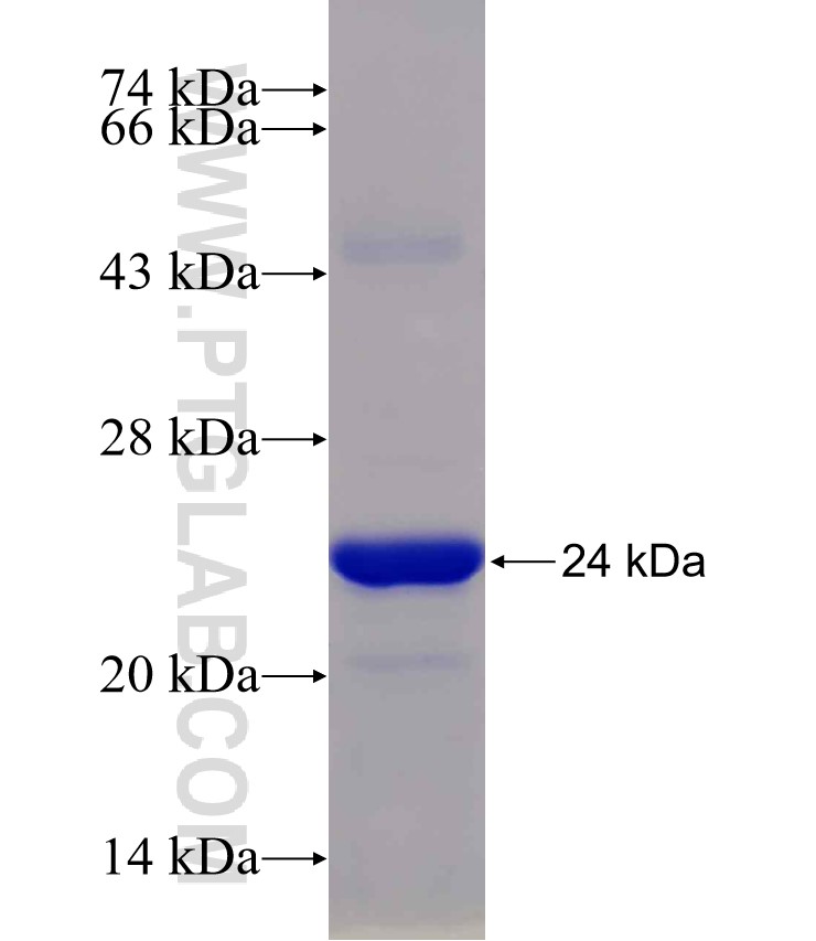 GSDMB fusion protein Ag30217 SDS-PAGE