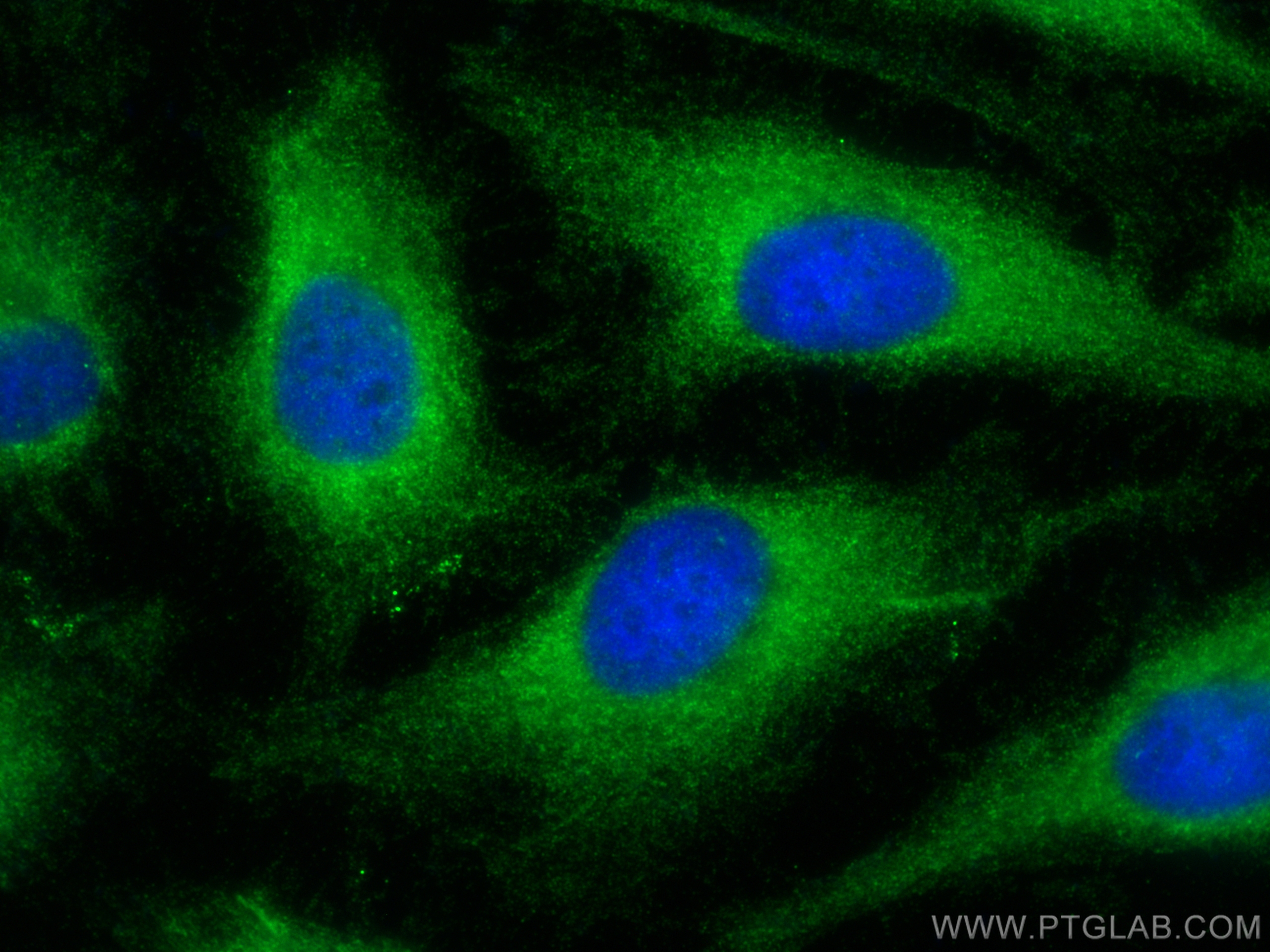 IF Staining of HeLa using 20770-1-AP