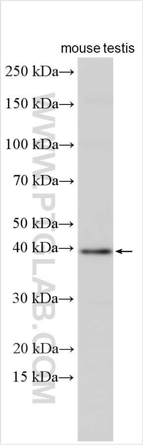 WB analysis using 15258-1-AP