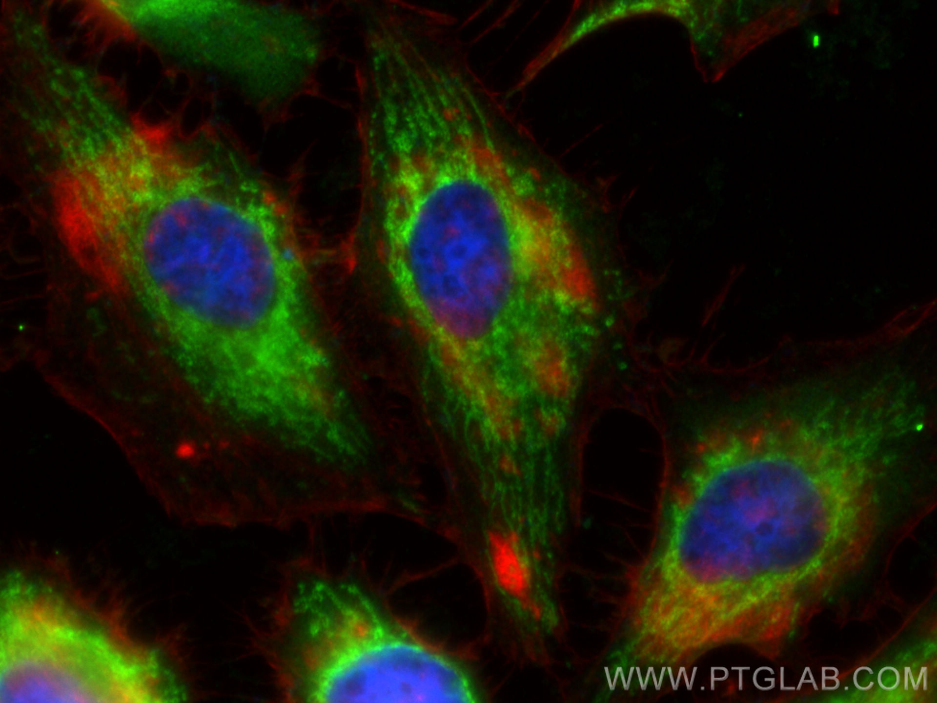 IF Staining of HeLa using 13419-1-AP