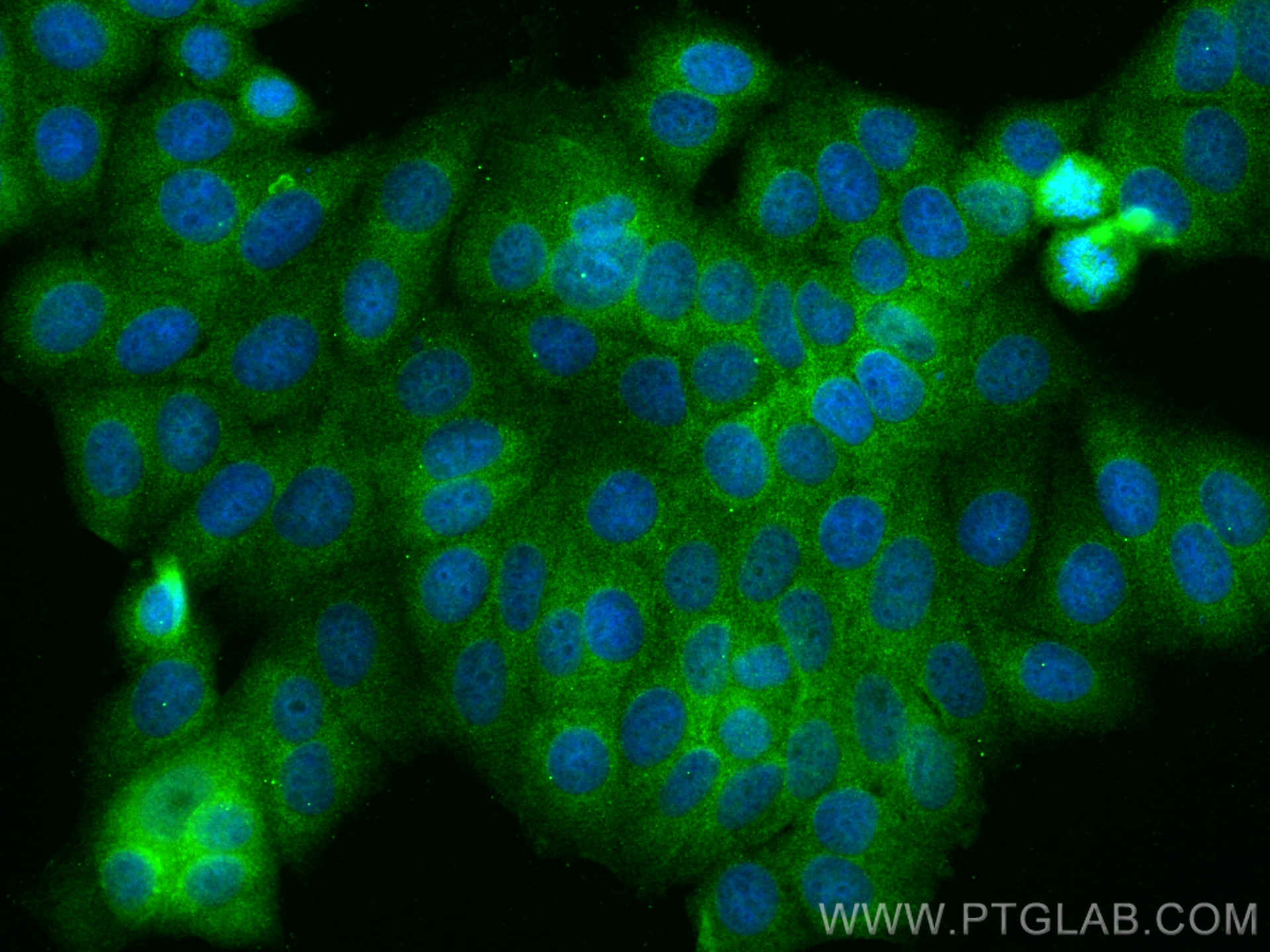 IF Staining of MCF-7 using 22104-1-AP