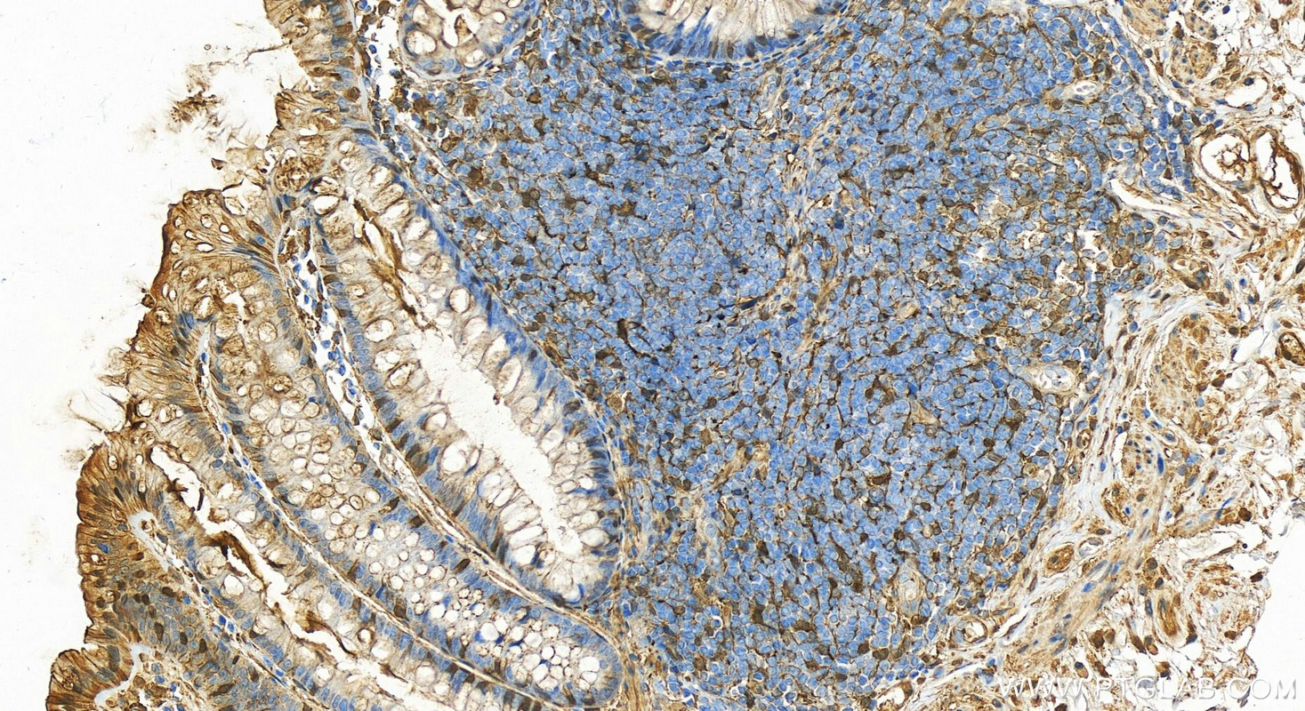 IHC staining of human colon using 11644-2-AP