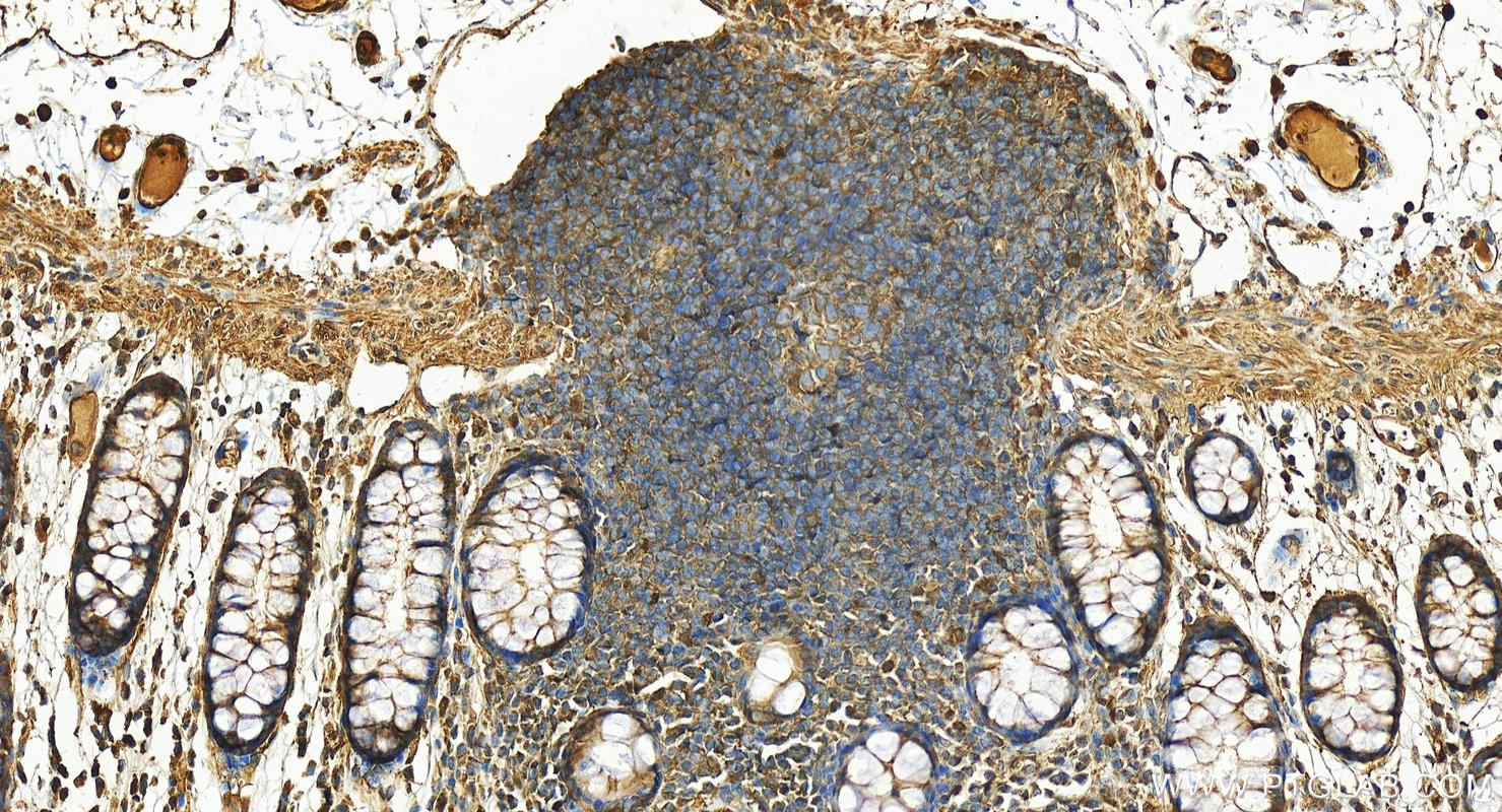 IHC staining of human colon using 11051-1-AP