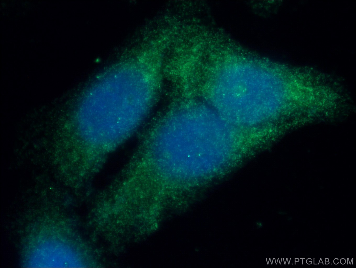 IF Staining of HepG2 using 11051-1-AP