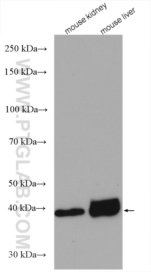 WB analysis using 11051-1-AP