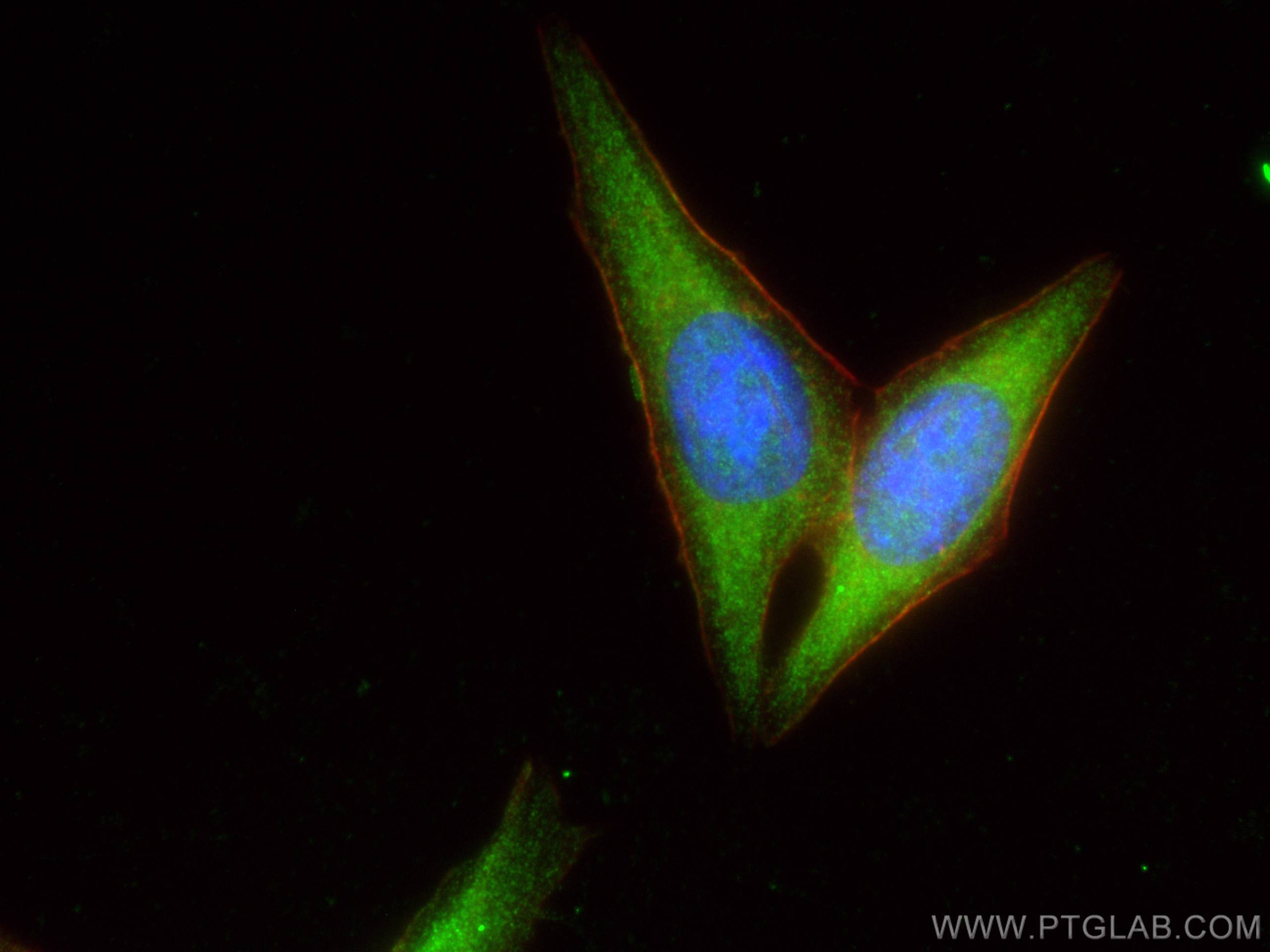 IF Staining of HepG2 using 16379-1-AP