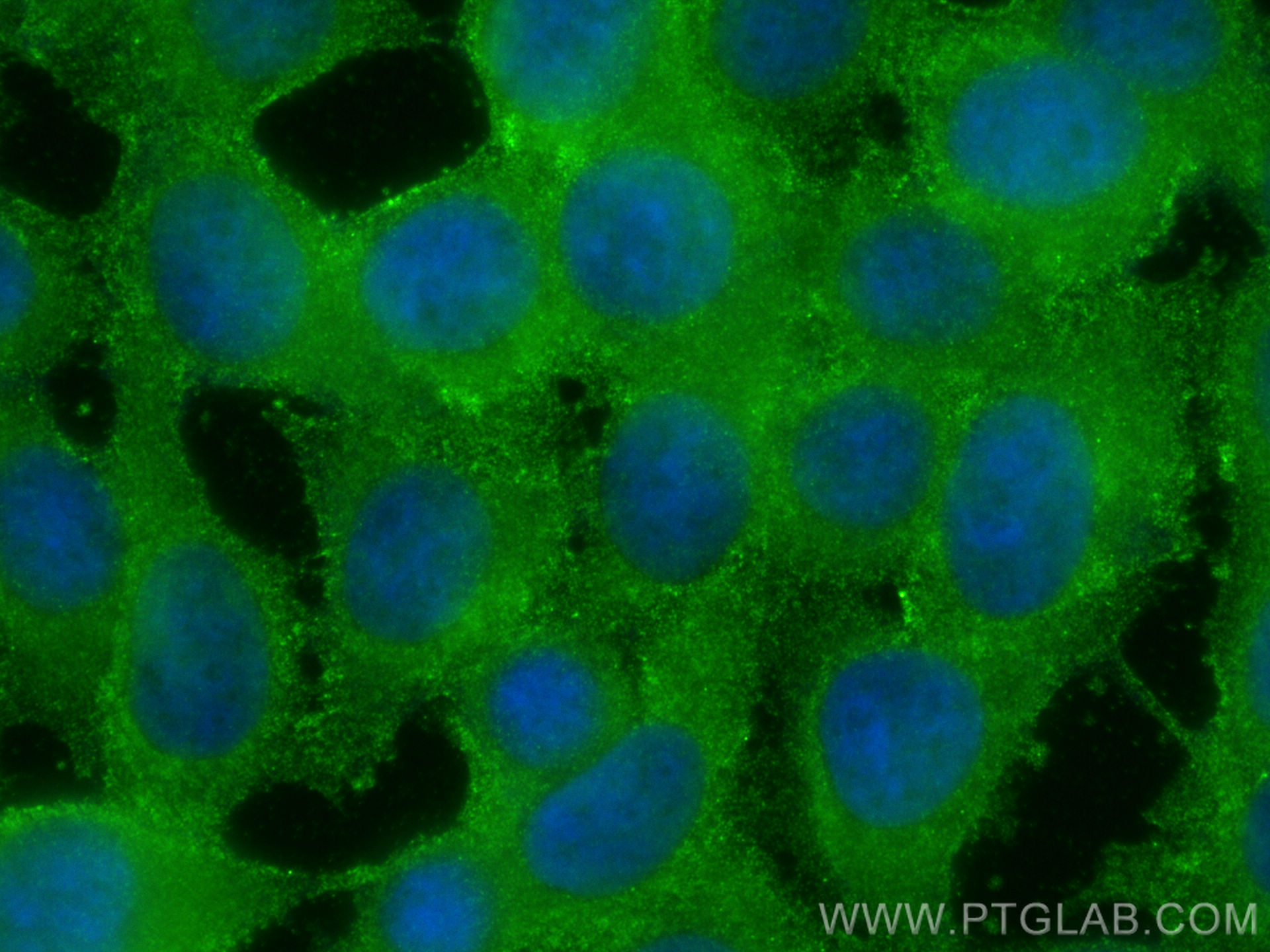 IF Staining of MCF-7 using 16703-1-AP