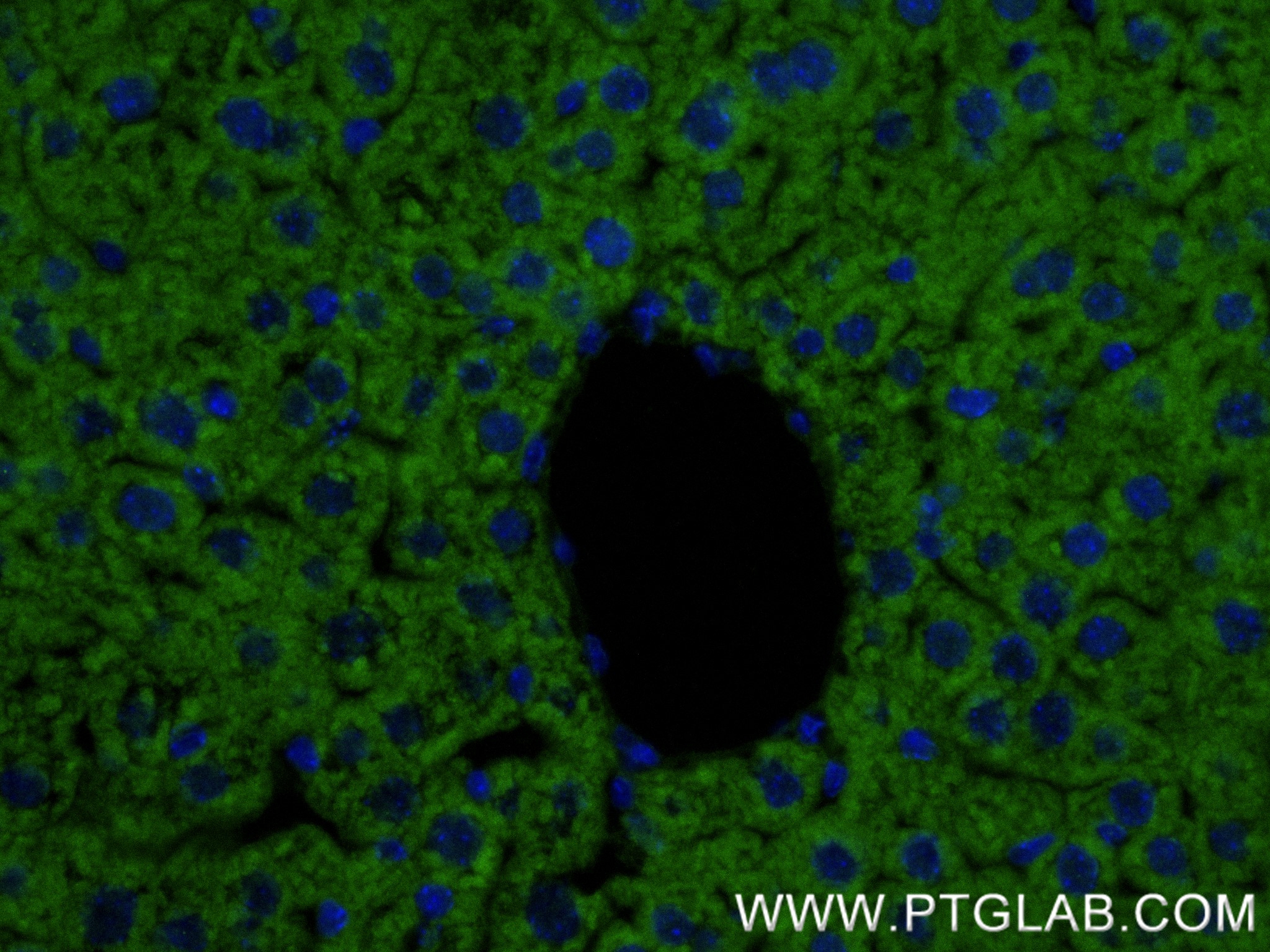 IF Staining of mouse liver using 81527-1-RR