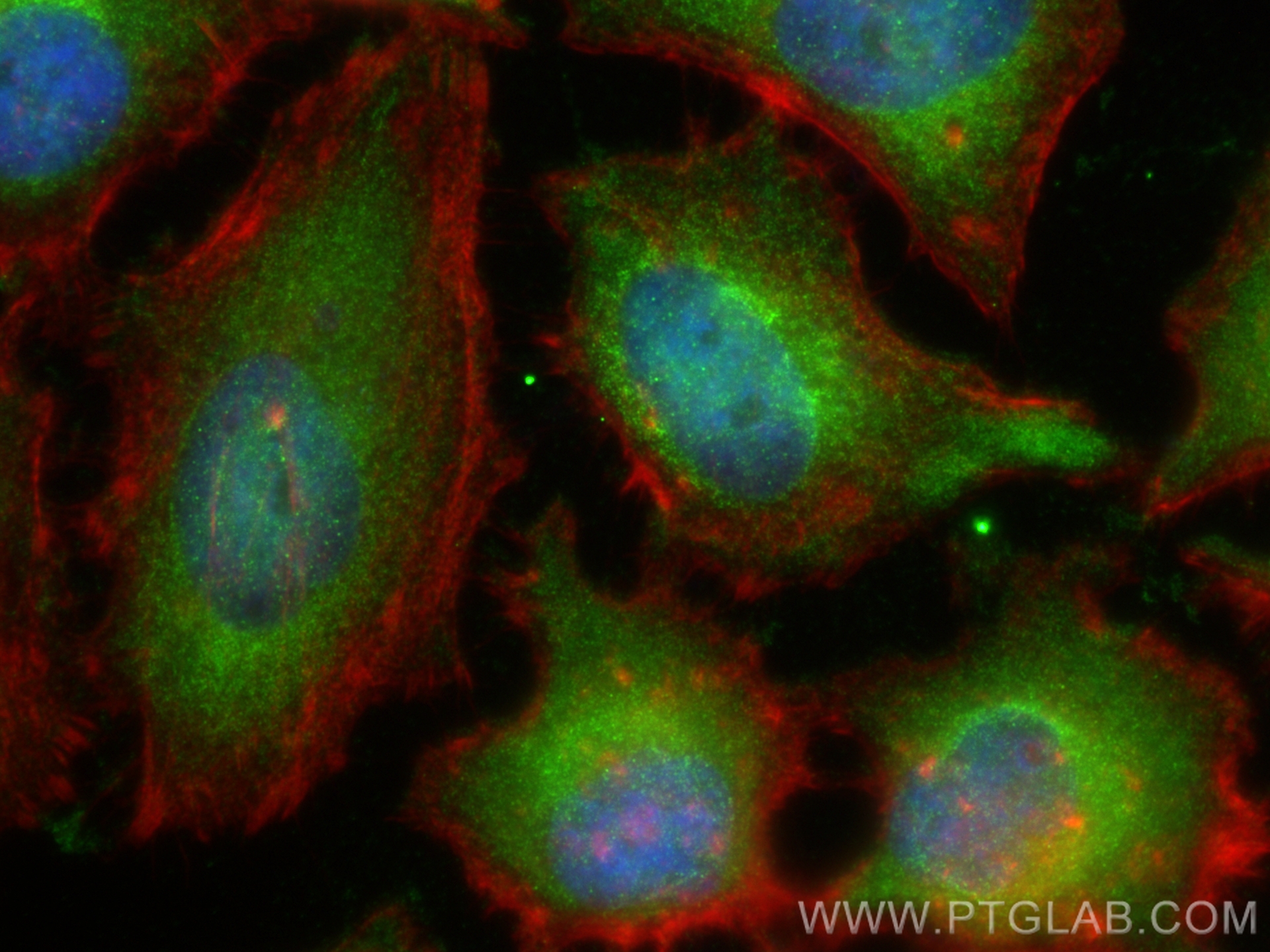 IF Staining of HeLa using 67862-1-Ig (same clone as 67862-1-PBS)