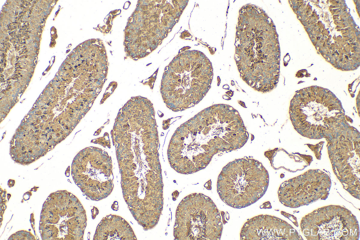 IHC staining of mouse testis using 15214-1-AP