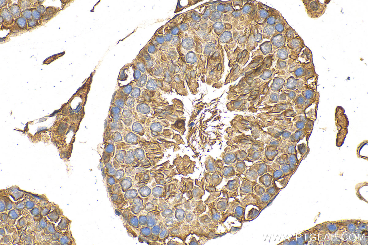 IHC staining of mouse testis using 15214-1-AP