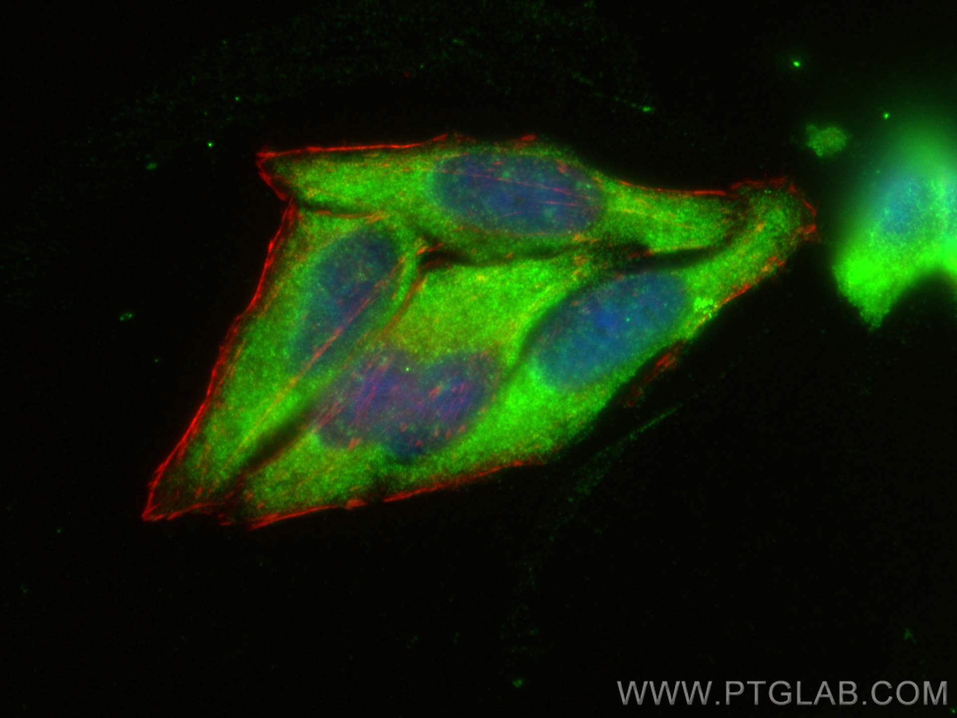 IF Staining of HepG2 using 16766-1-AP