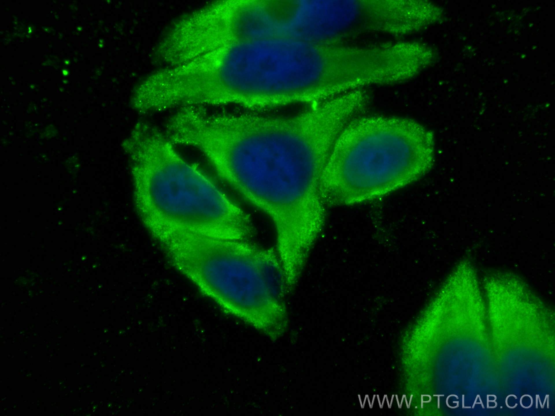 IF Staining of HepG2 using 14502-1-AP