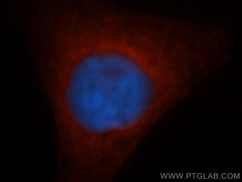 IF Staining of HepG2 using 14502-1-AP