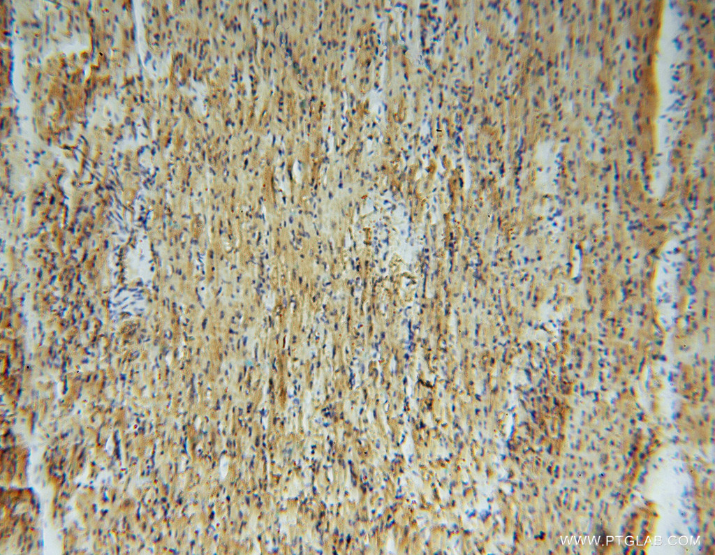 IHC staining of human heart using 14502-1-AP