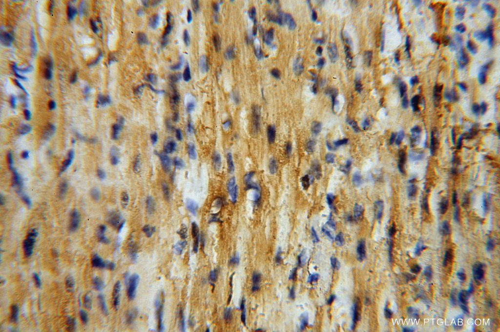 IHC staining of human heart using 14502-1-AP